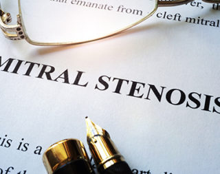 Acute Myocardial Infraction