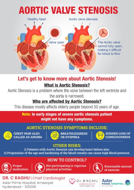 What Are Aortic Stenosis Symptoms And Causes? | Dr. C Raghu