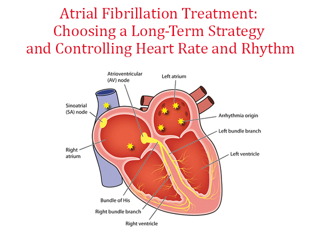 Atrial Fibrillation Treatment: Choosing a Long-Term Strategy and Controlling Heart Rate and Rhythm