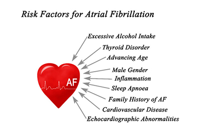 atrial-fibrillation-factor.jpg