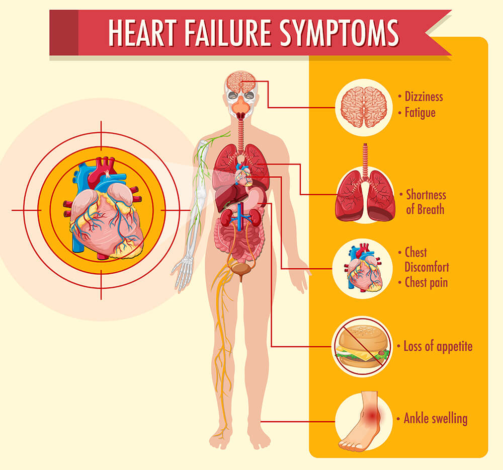 heart failure system