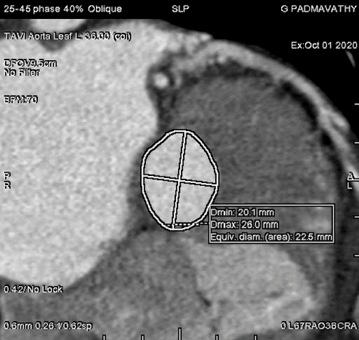 CT-Angiogram.png