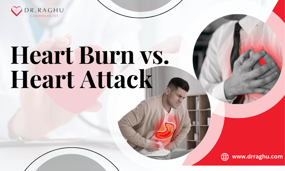 Heartburn vs. Heart Attack