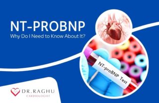 NT-proBNP
