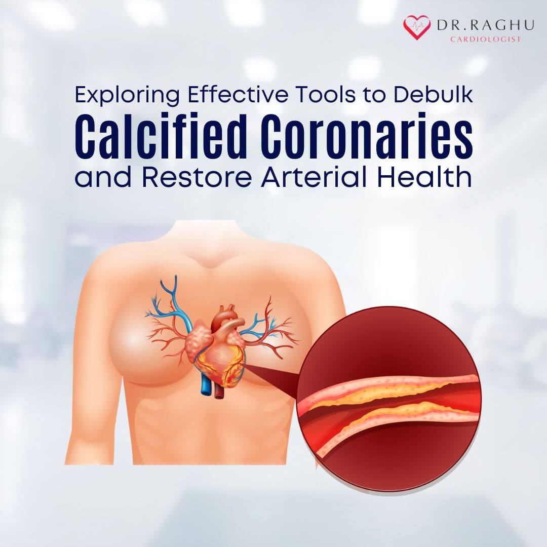Calcified Coronaries