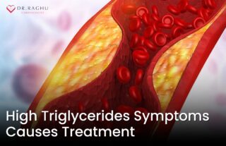 High Triglycerides