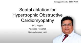 Septal Ablation for HOCM