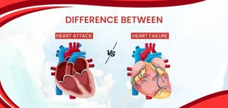 Heart Attack and Heart Failure