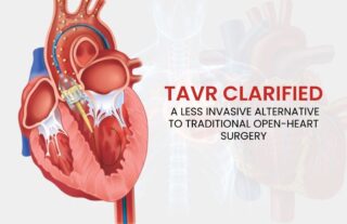 TAVR expert in Hyderabad