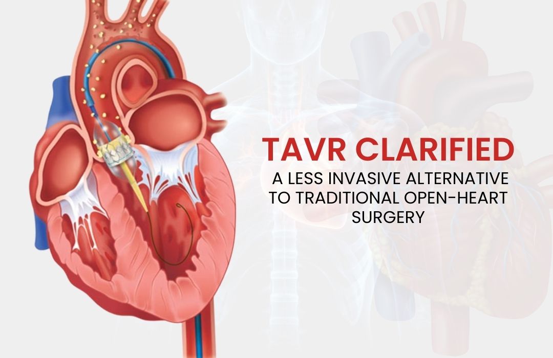 TAVR.jpg