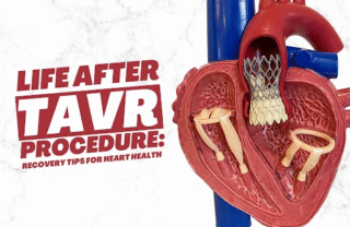TAVR expert in India