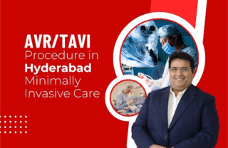 TAVRTAVI Procedure in Hyderabad