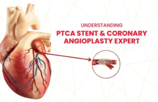 PTCA STENT & CORONARY ANGIOPLASTY EXPERT