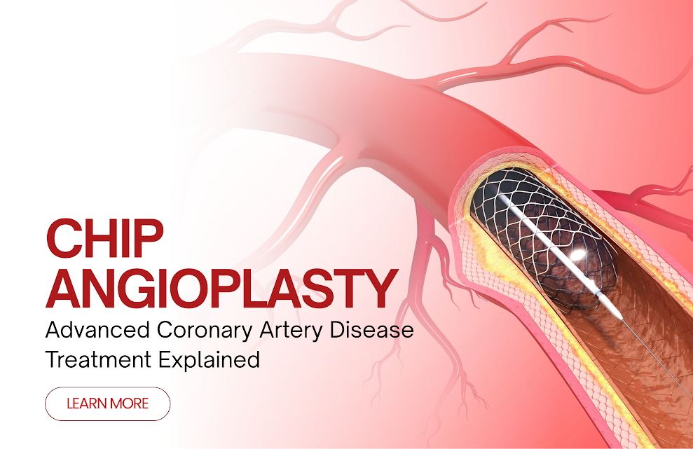 Chip-angioplasty.webp