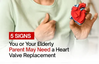 heart valve replacement