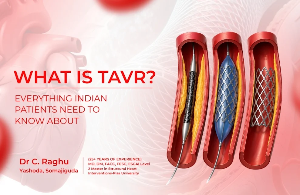 tavr-specialist-in-india.webp