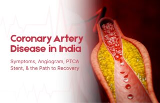 Coronary Artery Disease in India