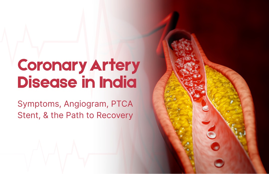 Coronary-Artery-Disease-in-India.jpg