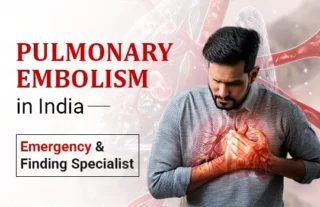 pulmonary embolism in india