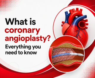 Coronary angioplasty