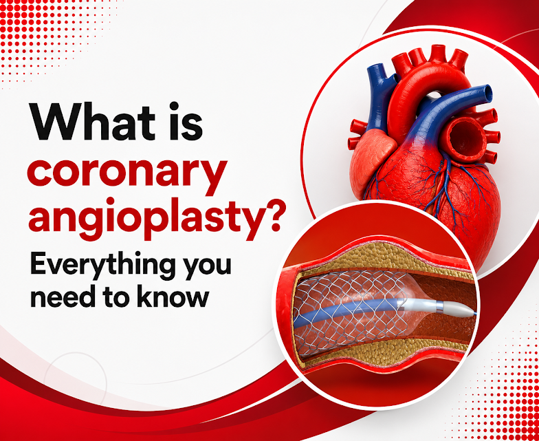 Coronary angioplasty