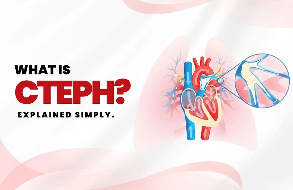 WHAT-IS-CTEPH.webp