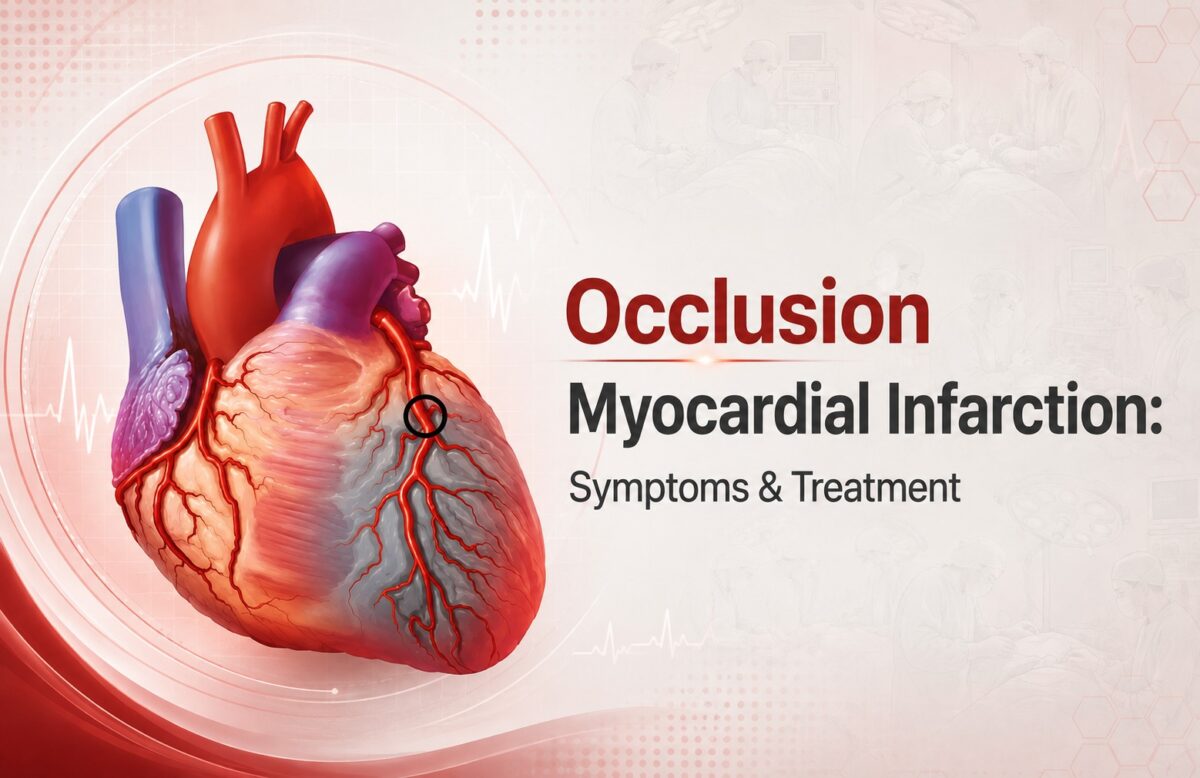 Occlusion-Myocardial-Infarction-Symptoms-Treatment-1-1200x778.jpeg