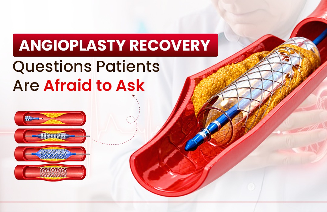 Angioplasty-in-heart.jpg