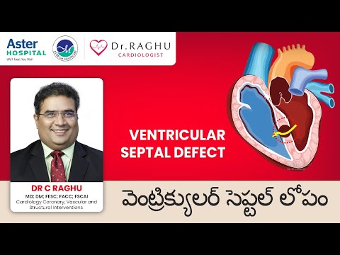 Ventricular septal defect | Heartbeat murmurs | Heart defects | VSD procedure | Dr C Raghu