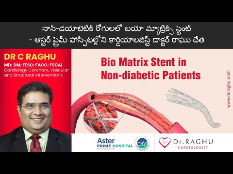 What are biomatrix stents | Why biomatrix stents for non-diabetic heart patients? | Dr. Raghu