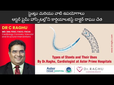 Types of stents | What is stents | Stents treatment | Dr Raghu