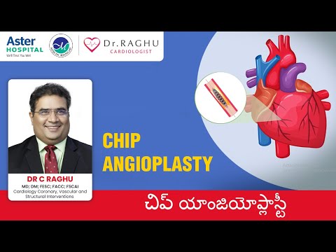 When to prefer CHIP treatment | How is CHIP Treatment beneficial| Dr C Raghu| Cardiologist