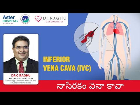 Reason for calf pain | What is IVC Filters | Procedure of IVC