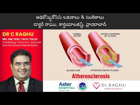 What is Atherosclerosis | Symptoms of Atherosclerosis | early signs of Atherosclerosis | Dr C Raghu